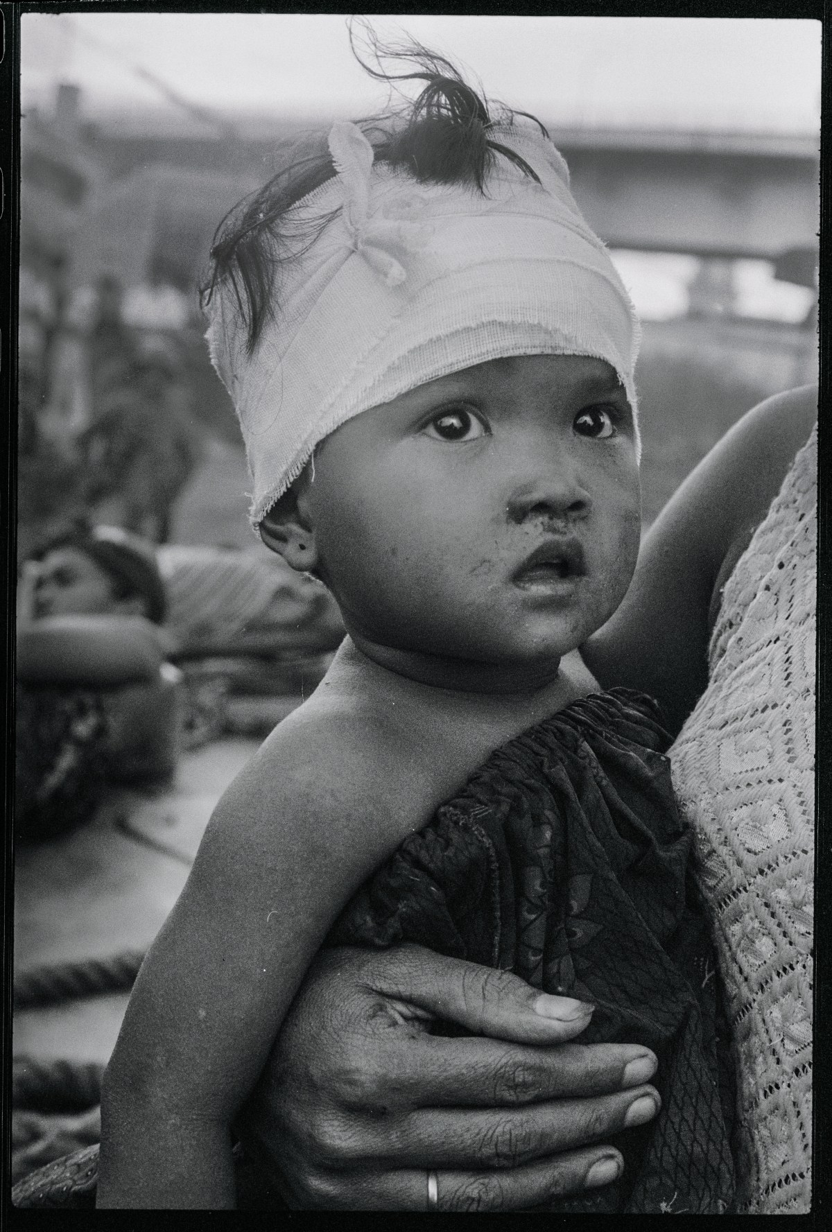 (Original Caption) Victim of U.S. Bombing Error. Phnom Penh: Wearing head bandage, this young Cambodian youngster is one of some 300 casualties of bombing error on Neak Luong by U.S. warplanes August 6. He and other victims are awaiting transportation to hospital after having been brought here by Navy boats August 7.